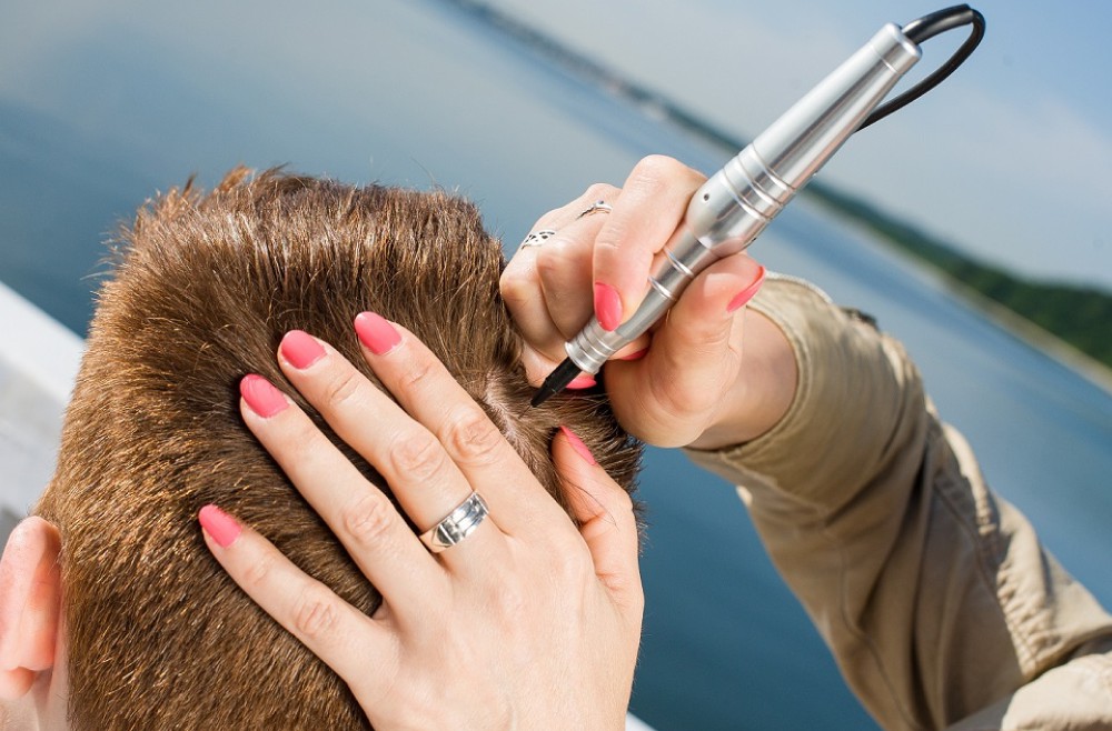 Micropigmentation of the scalp